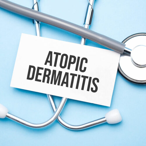 3 strategies for managing atopic dermatitis