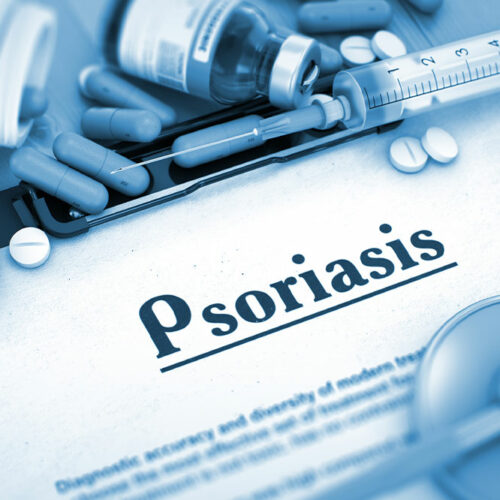 6 common health conditions linked to psoriasis